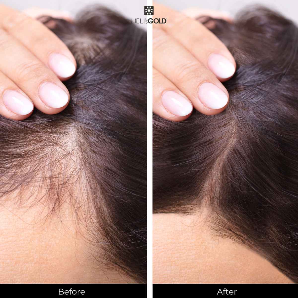 Antidote Scalp&Hair Revitalizer 50 ml