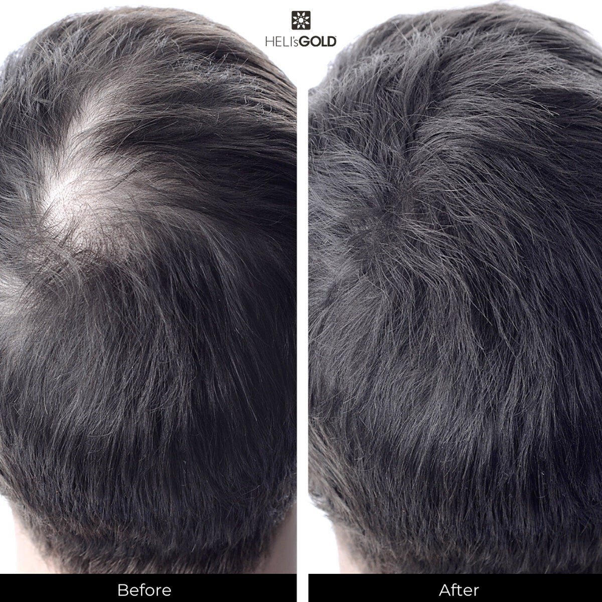 Antidote Scalp&Hair Revitalizer 50 ml